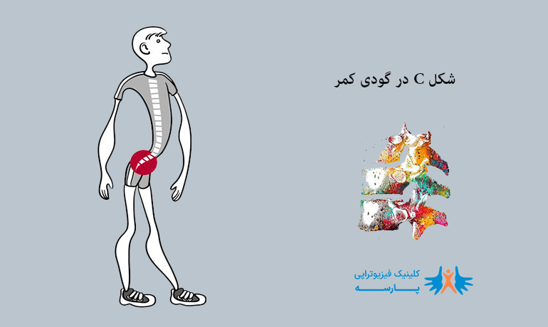 گودی کمر