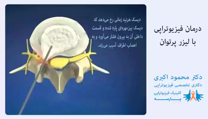 درمان فیزیوتراپی با لیزر پرتوان