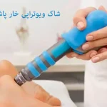 شاک ویو تراپی خار پاشنه